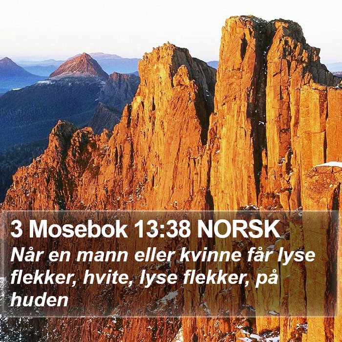 3 Mosebok 13:38 NORSK Bible Study